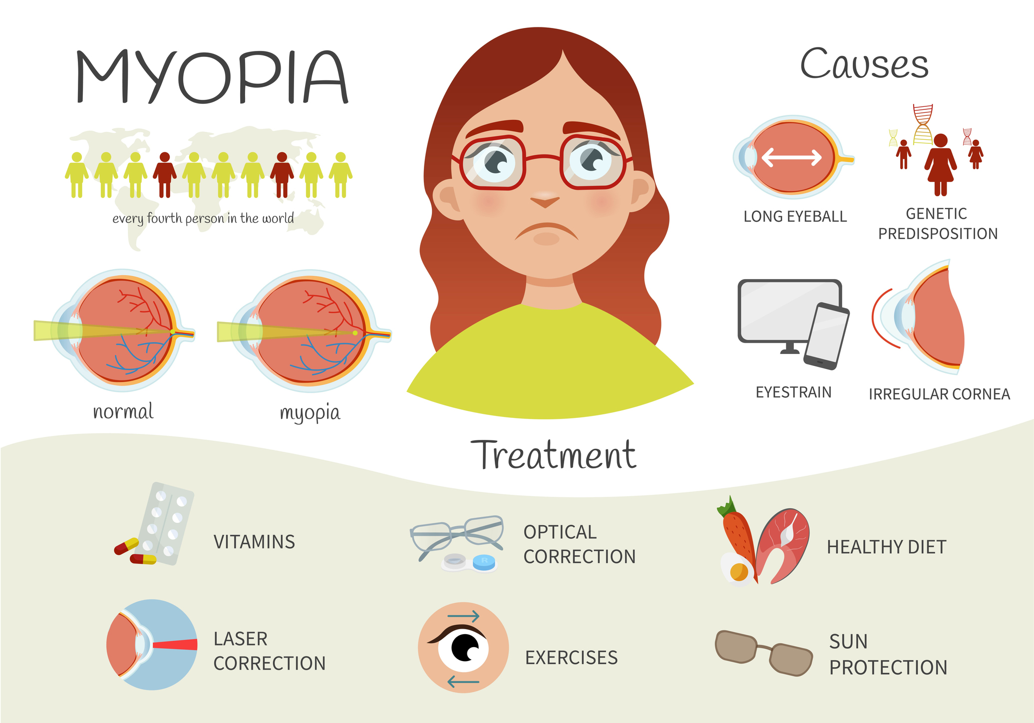 Infographics of myopia. Review of Myopia Management