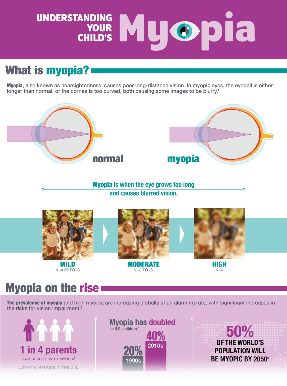 recent research suggests myopia may be caused by