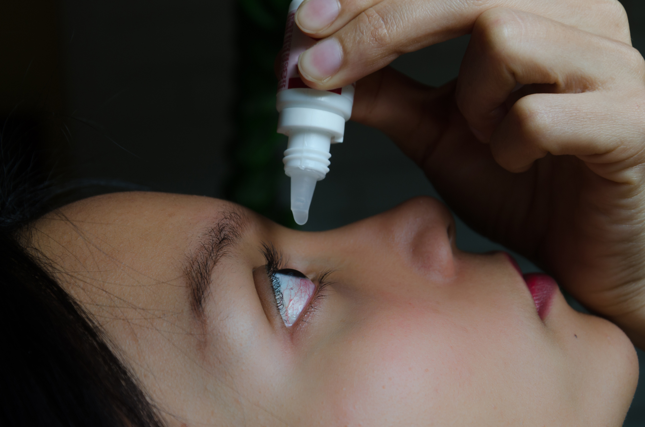 Woman applying eye-drops into her eye