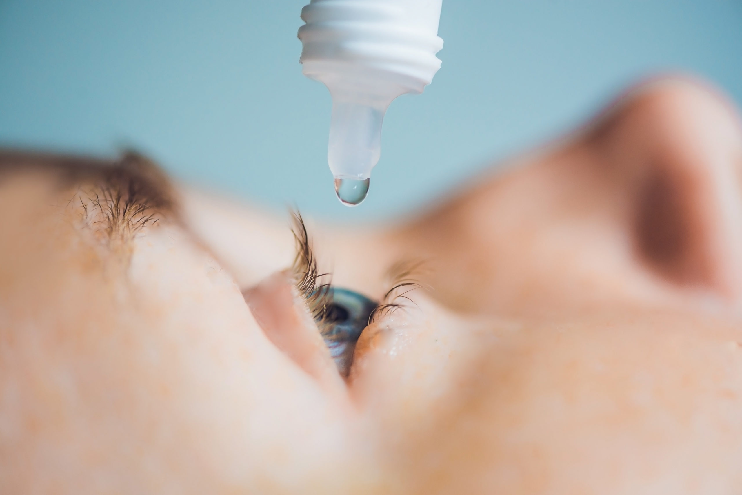 Closeup of eyedropper putting liquid into open eye