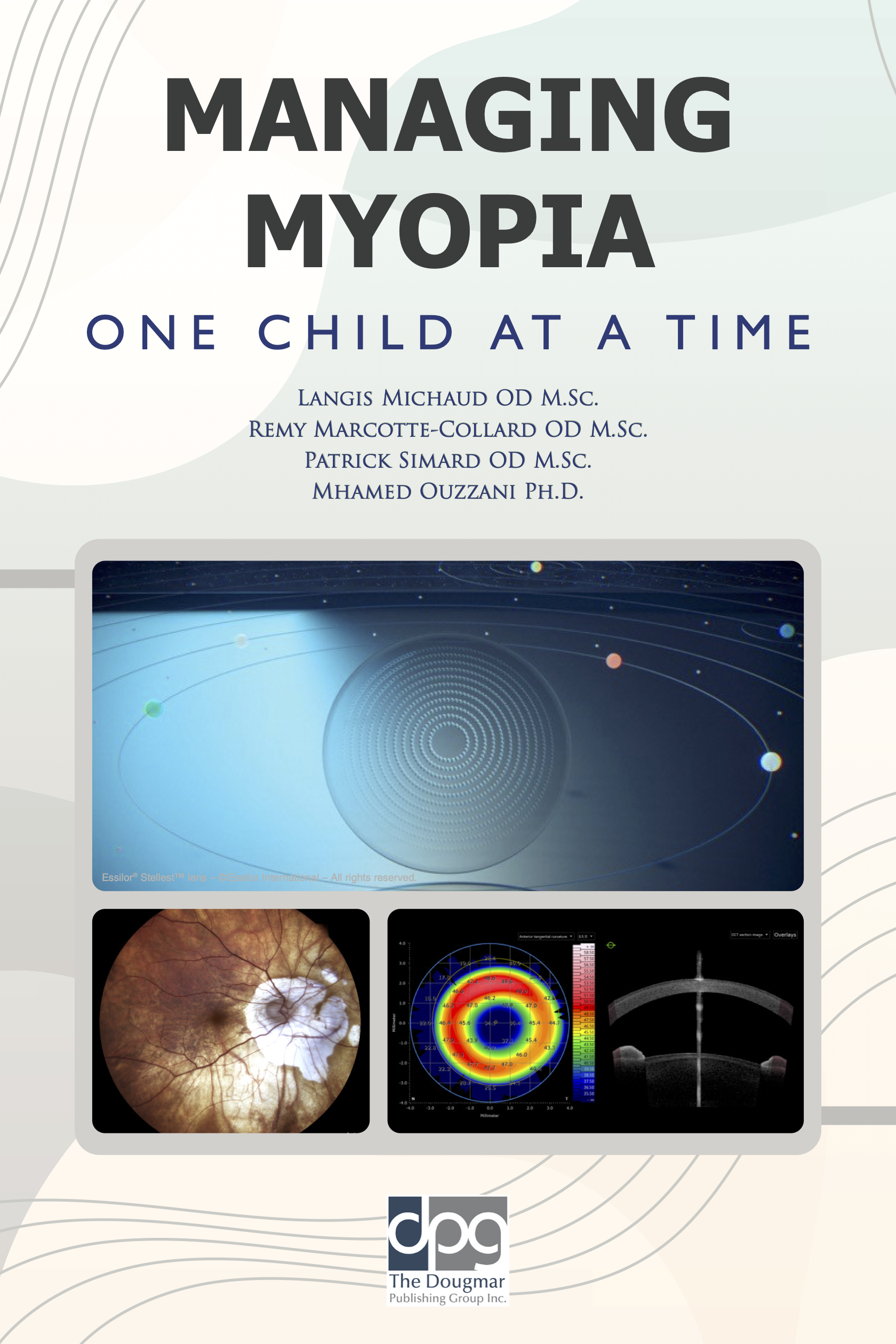 Book Review: Managing Myopia Child At A Time - Review of Myopia