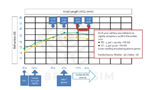 This chart shows the effect of H.A.L.T. spectacles and low-dose atropine. 