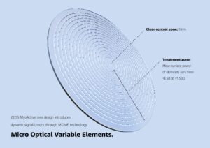 The MyoActive lens